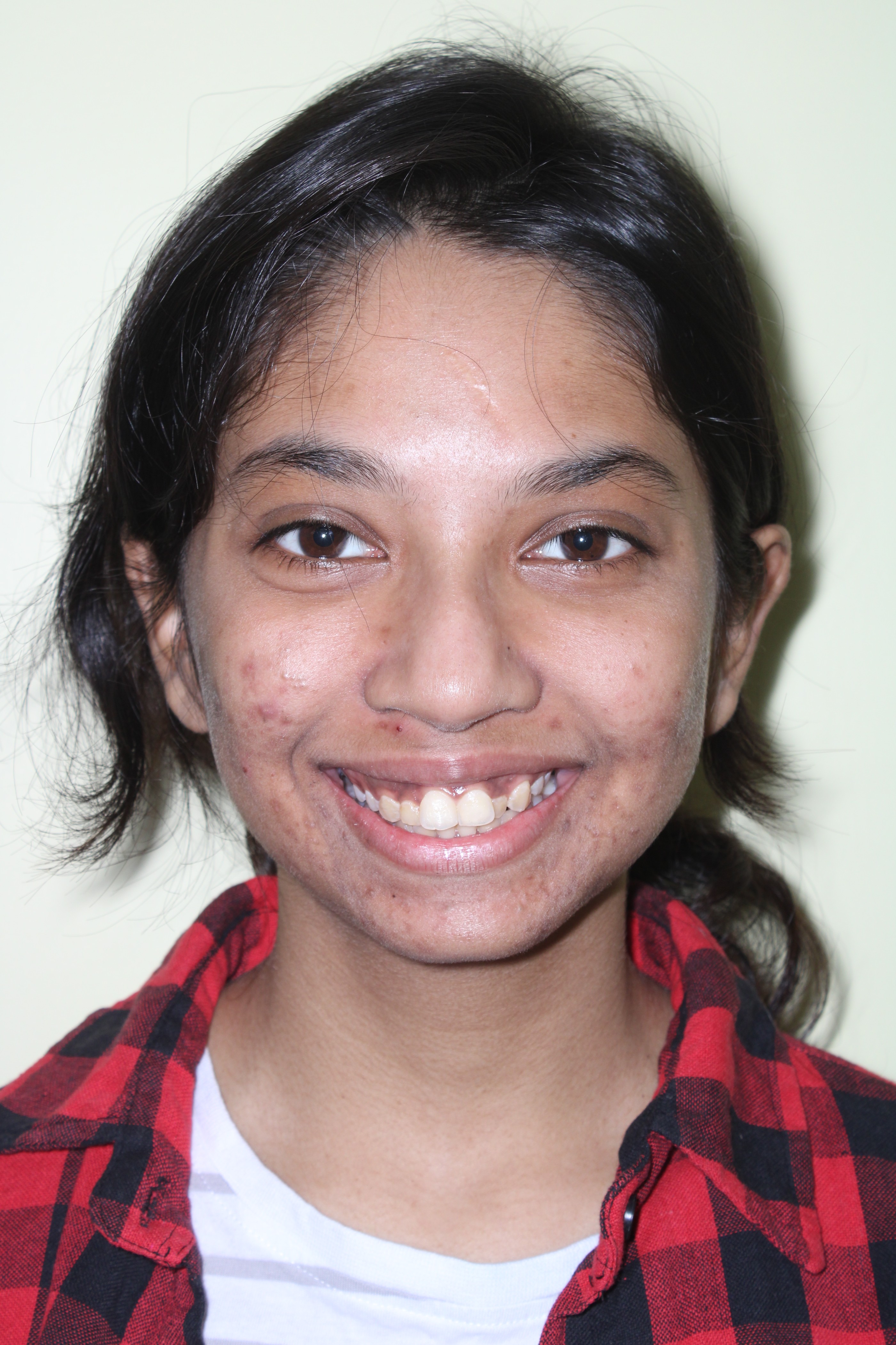 Nilanjana Before