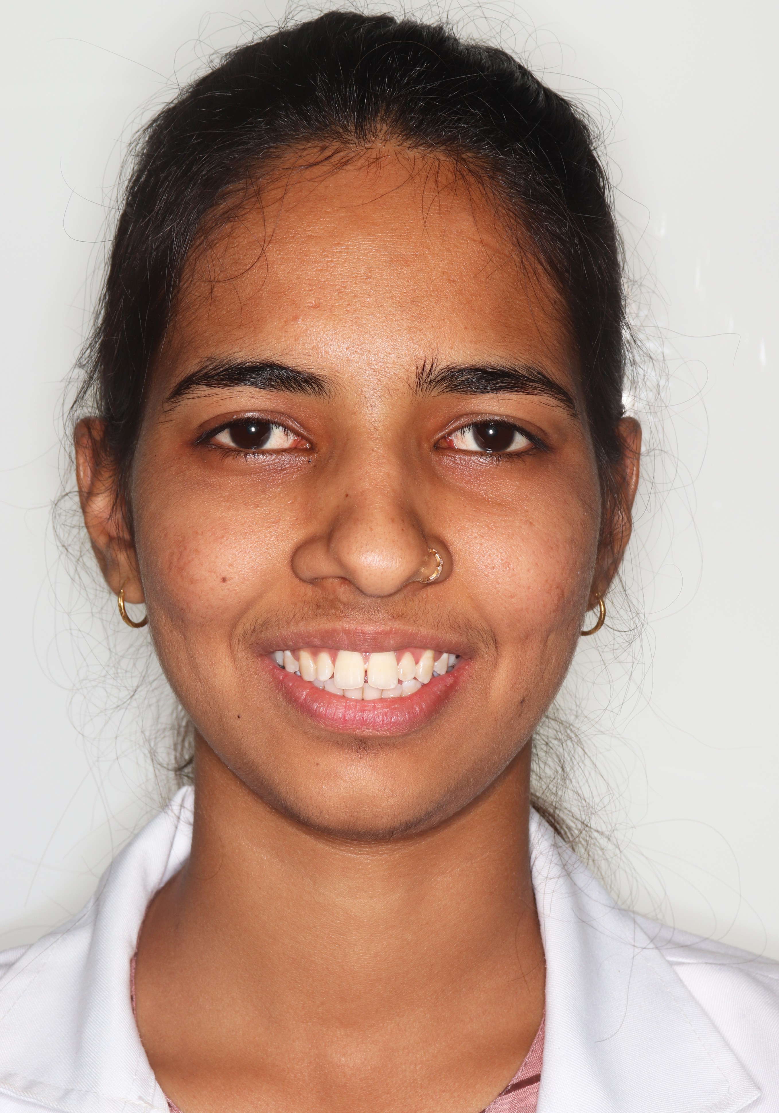 Yogita Before